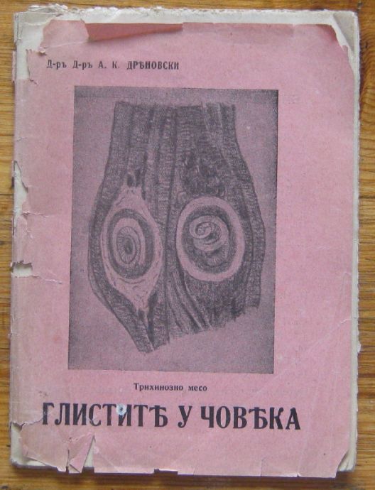 ГЛИСТИТЕ У ЧОВЕКА, А. К. ДРЕНОВСКИ